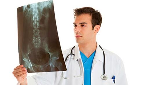 o médico examinará unha radiografía para diagnosticar a dor lumbar